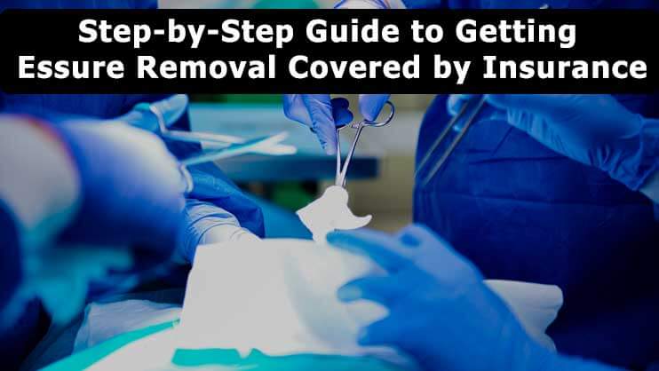Step by Step Guide to Getting Essure Removal Covered by Insurance